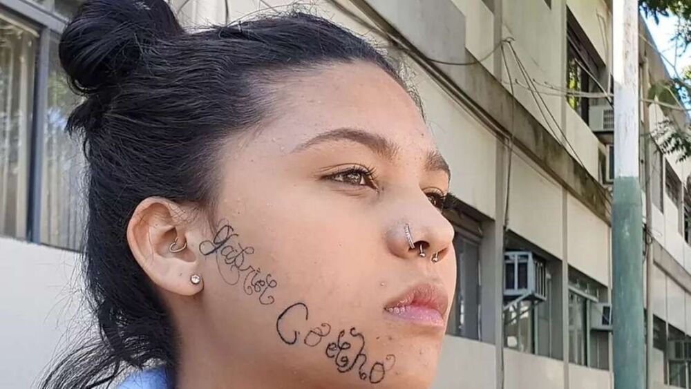 Joven de 18 años denuncia que su exnovio le tatuó a la fuerza su nombre en el rostro | Mundo | NoticiasCaracol