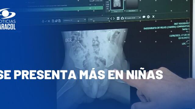 ¿Qué es la displasia de cadera y cómo tratarla a tiempo? ¿Qué es la displasia de cadera y cómo tratarla a tiempo?