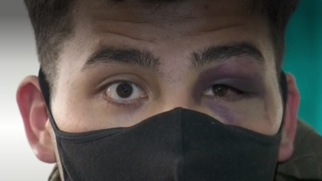 Thumbnail Thumbnail