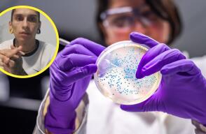 La bacteria candida auris causó una fuerte infección en el cuerpo de Javier Acosta