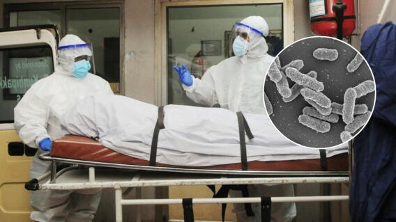 Yesinia Pestis, bacteria de la peste neumónica