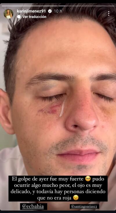 Santiago Arias y su golpe, tras el partido Bahía vs Botafogo Santiago Arias y su golpe, tras el partido Bahía vs Botafogo