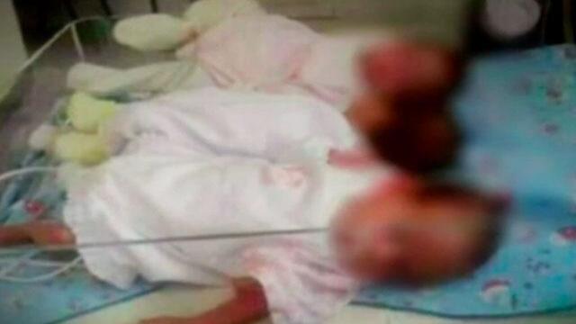 Abandono de estas trillizas recién nacidas conmueve a Argentina