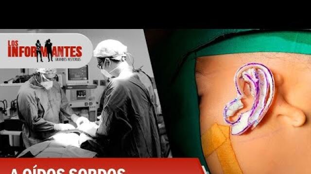 Thumbnail Thumbnail