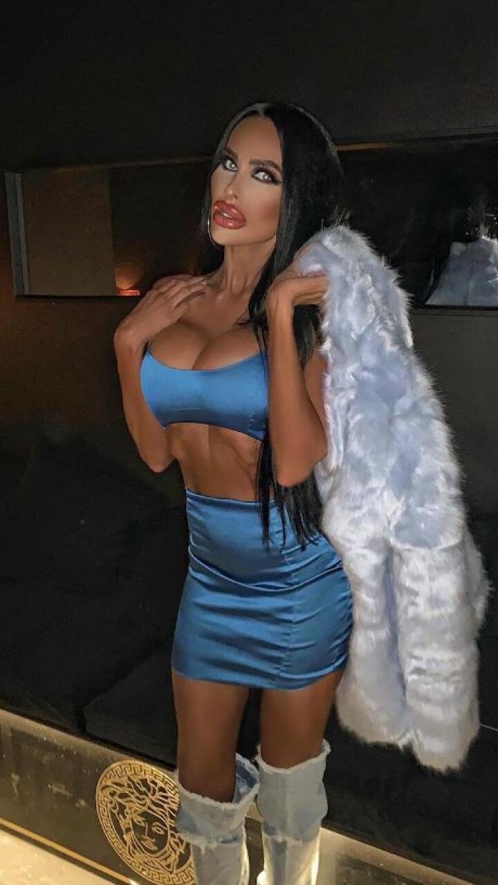 Así se ve la ‘Barbie humana’, una mujer que gastó miles en cirugías para parecer una muñeca