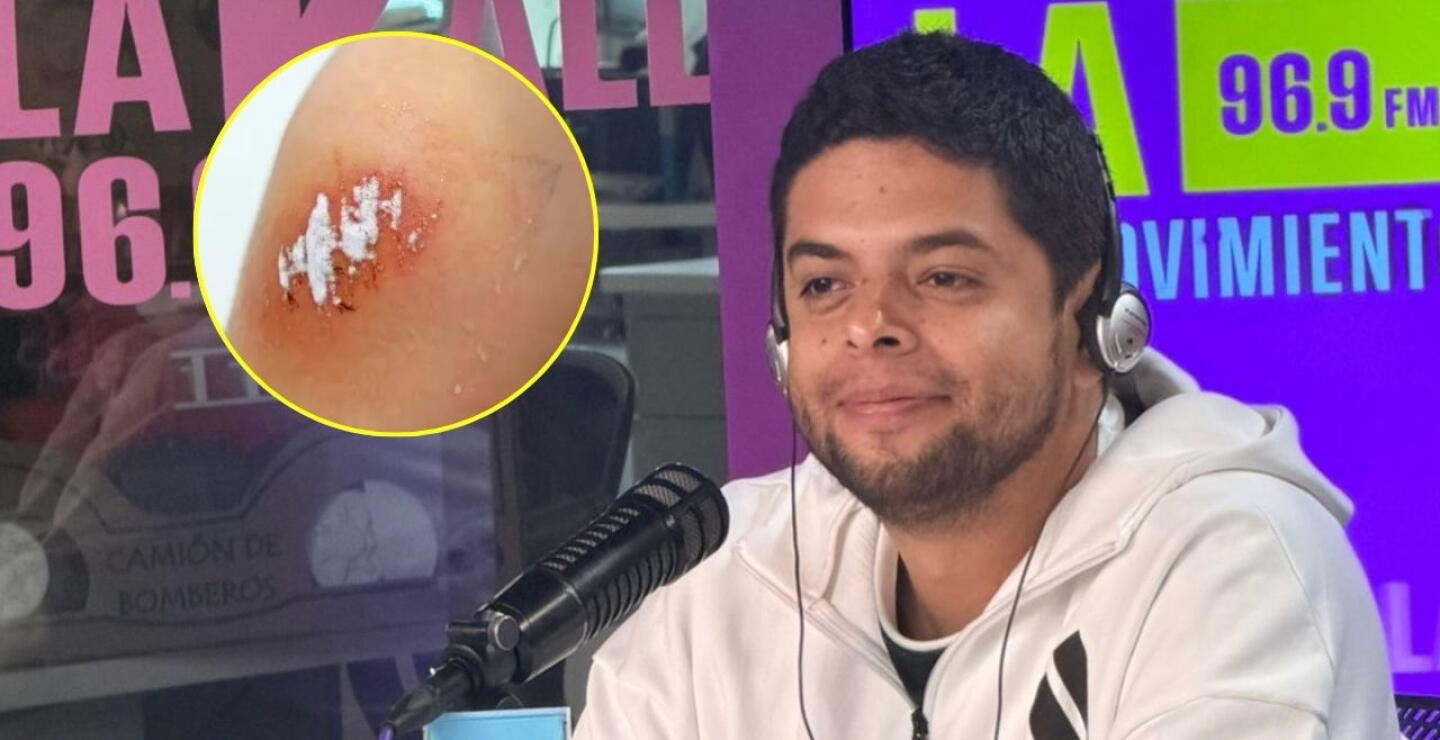 Faber Burgos habla sobre los riesgos que enfrenta su cuerpo por sus experimentos