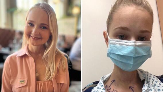 A esta joven le tuvieron que cortar parte de su lengua por cáncer A esta joven le tuvieron que cortar parte de su lengua por cáncer