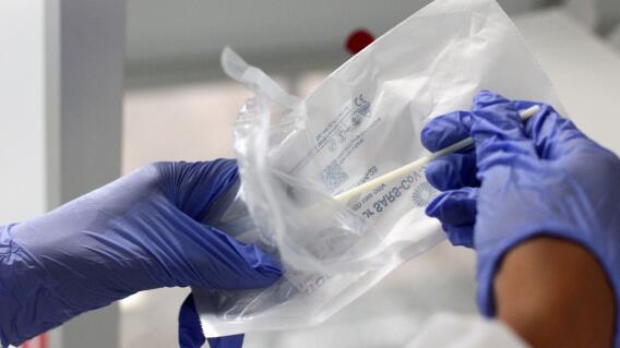 370393_Test coronavirus. Foto: AFP