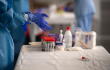 374919_Test coronavirus. Foto: AFP