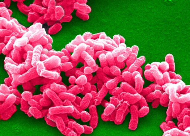 Virus Brucella :: Foto: Agencia de Sanidad Animal y Vegetal de Reino Unido.jpeg