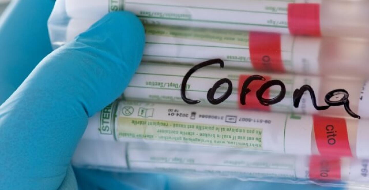 covid_casos_0.jpg