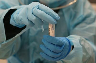 374920_Test coronavirus. Foto: AFP