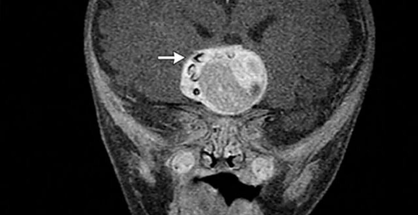 Foto: New England Journal of Medicine