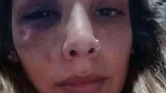 Macarena Bogado , mujer argentina víctima de maltrato por su pareja