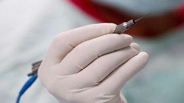 ¿Cuáles son los requisitos para que los menores desde los 14 años puedan hacerse cirugías estéticas?