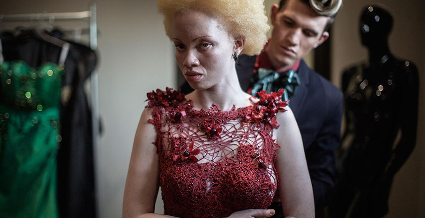 Jóvenes albinos, estigmatizados y perseguidos en varios países africanos, participaron el viernes en el concurso de belleza para la elección de los primeros Miss y Mister Albinismo Kenia, una forma como cualquier otra de luchar contra los prejuicios.</