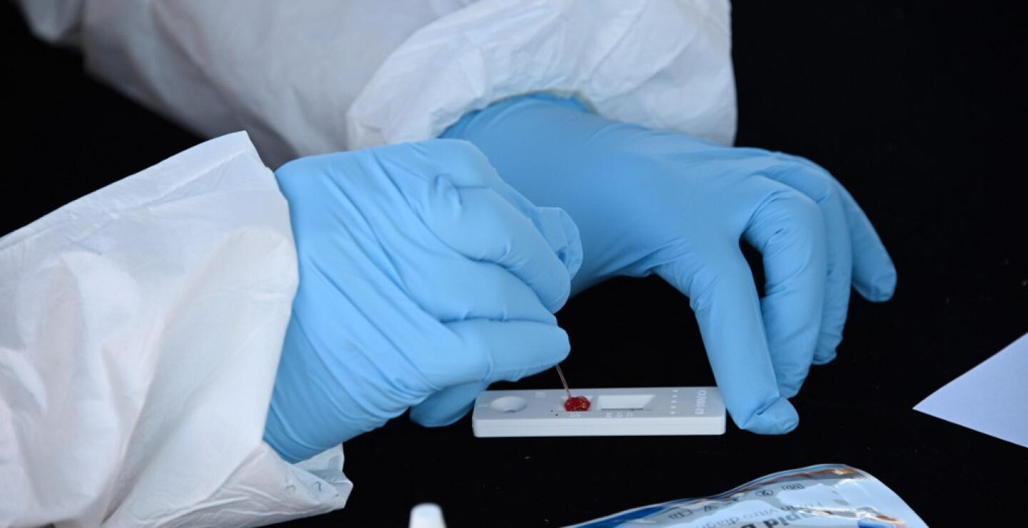 373404_Test coronavirus. Foto: AFP