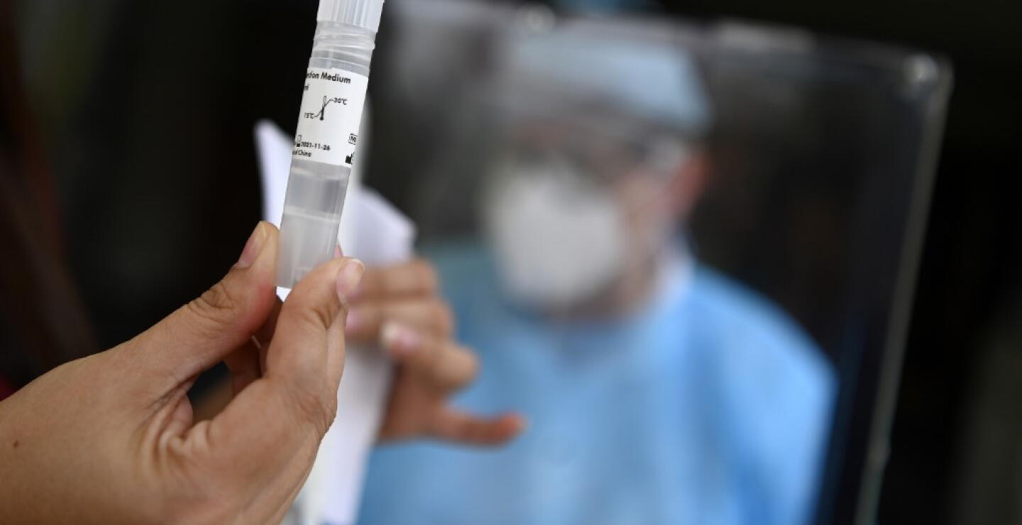 370677_Test coronavirus. Foto: AFP