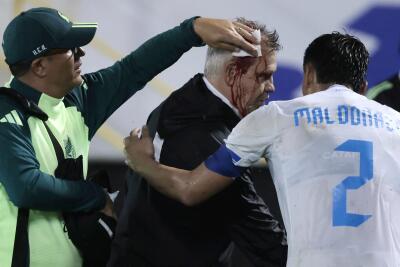 Javier Aguirre sufrió fuerte agresión en partido Honduras vs México Javier Aguirre sufrió fuerte agresión en partido Honduras vs México