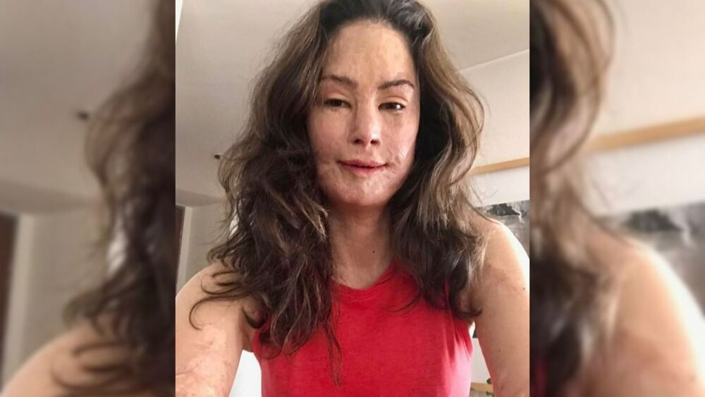 Natalia Ponce de León revela conmovedoras fotos de cómo era antes de