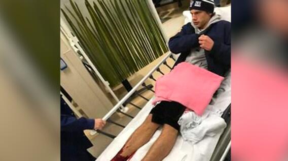 5112_La Kalle Joven fue atacado por piojos marinos - Foto - Video Cimacast 5112_La Kalle Joven fue atacado por piojos marinos - Foto - Video Cimacast