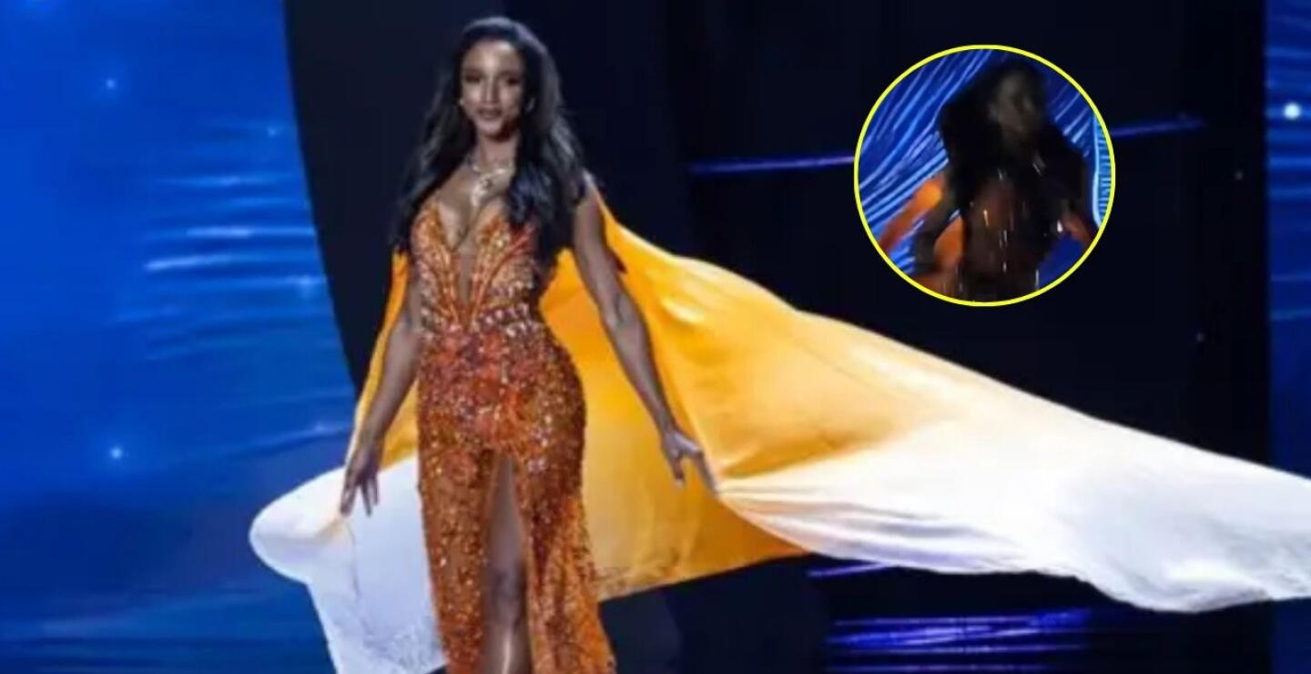 ¿Sigue en la UCI? Revelan verdadero estado de salud de Miss Jamaica, tras su fuerte caída