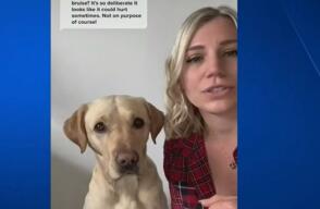 Una amistad que salva vidas: este perrito puede olfatear los niveles de azúcar de su ama diabética