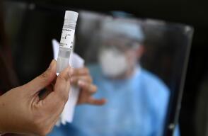 370677_Test coronavirus. Foto: AFP