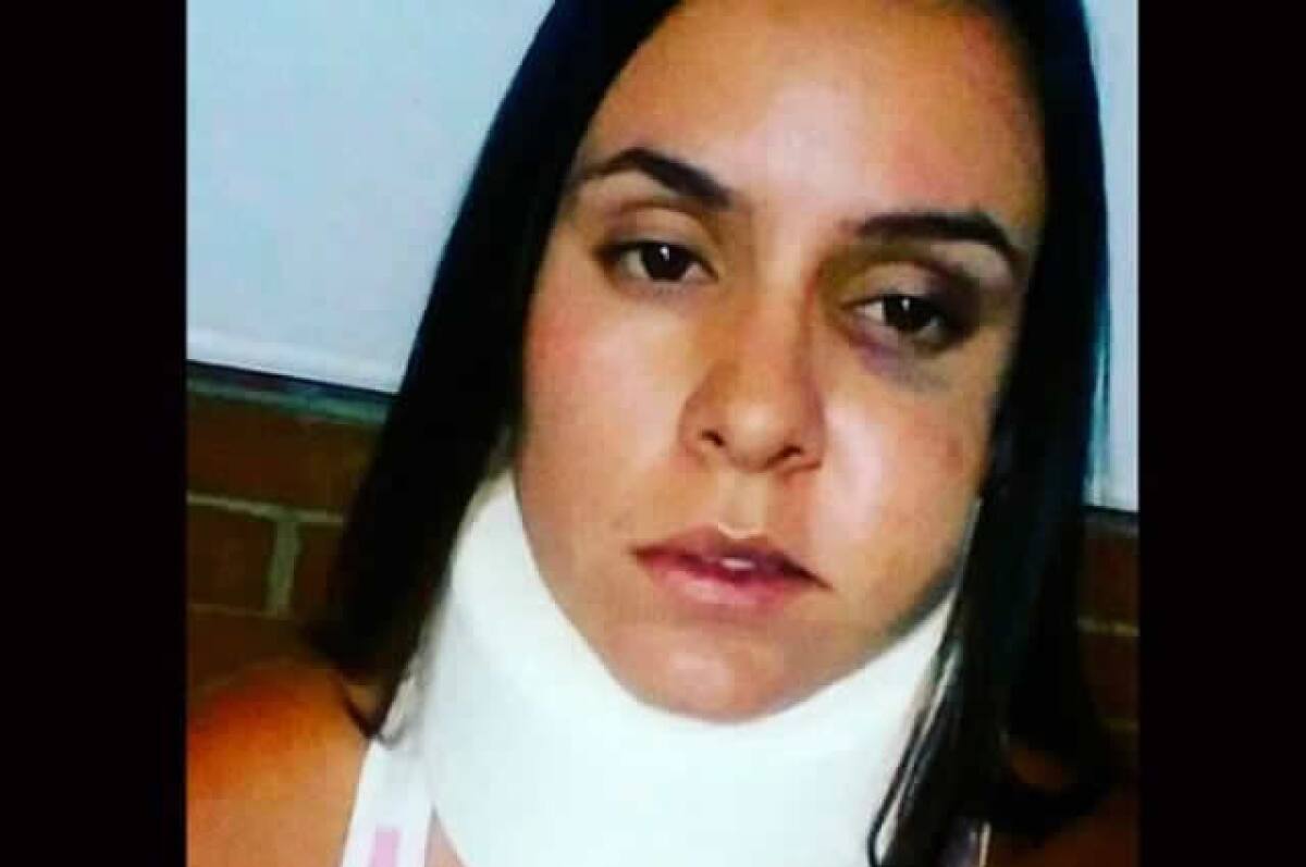 260915_modelo_golpeada.jpg