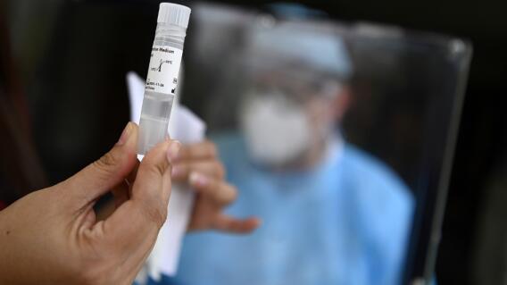 370677_Test coronavirus. Foto: AFP 370677_Test coronavirus. Foto: AFP