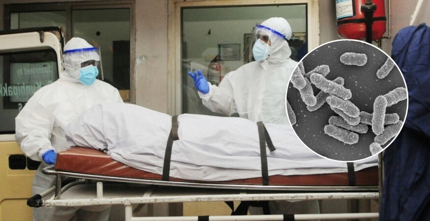 Yesinia Pestis, bacteria de la peste neumónica