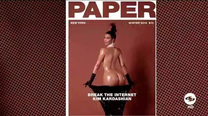 ¿Cuántas cirugías tiene Kim Kardashian en su cuerpo? Los expertos hablan