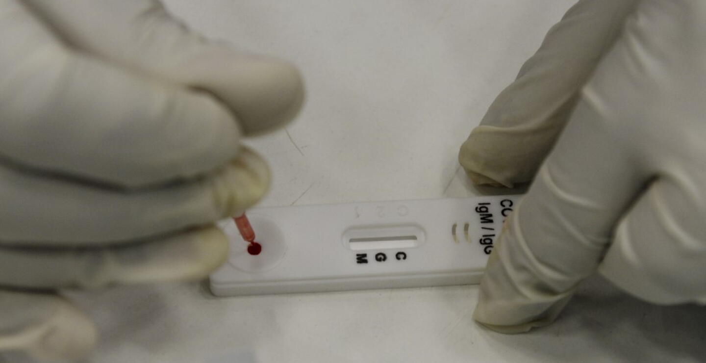 371528_Test coronavirus. Foto: AFP