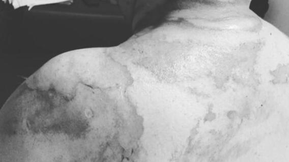 335396_BLU Radio. A la cárcel mujer que quemó a su esposo en Barranquilla / Foto: Cortesía