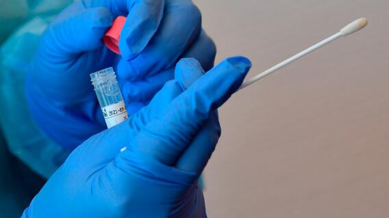 373106_Prueba COVID-19 // Foto: AFP, imagen de referencia