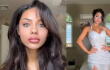 Dina Khalil, modelo y estrella de TikTok, casi pierde la vista por procedimiento estético.
