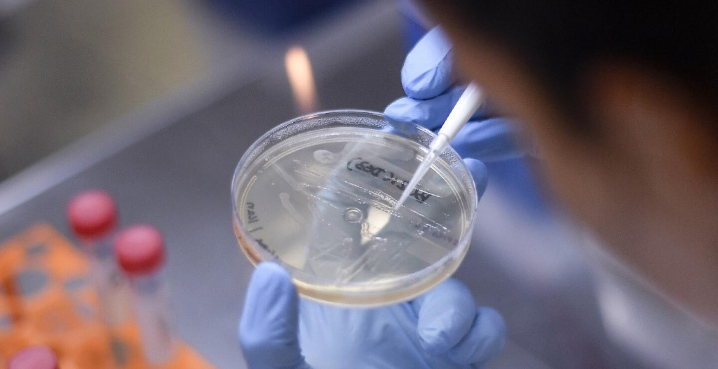 371646_Test coronavirus. Foto: AFP