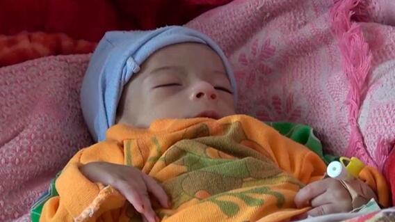 Niños Yemen Niños Yemen