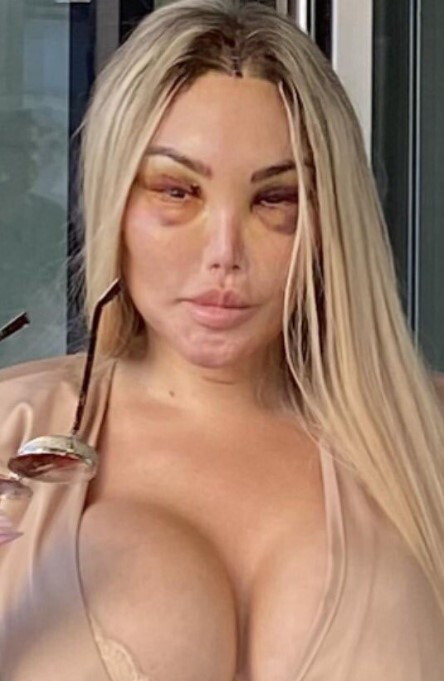 Barbie humana