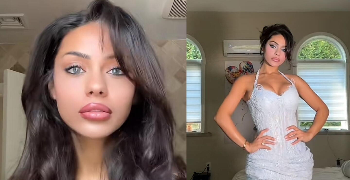 Dina Khalil, modelo y estrella de TikTok, casi pierde la vista por procedimiento estético.
