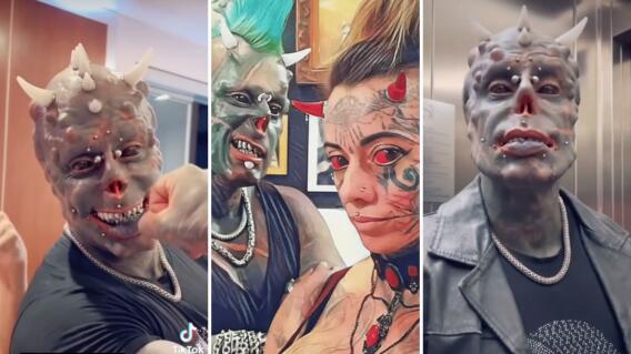“Satán Humano” ganó un récord Guinness por ser el hombre con más implantes de cuernos en la cabeza “Satán Humano” ganó un récord Guinness por ser el hombre con más implantes de cuernos en la cabeza