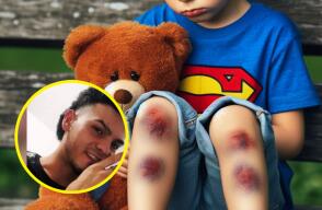 Niño de 3 años golpeado por orinarse en la cama