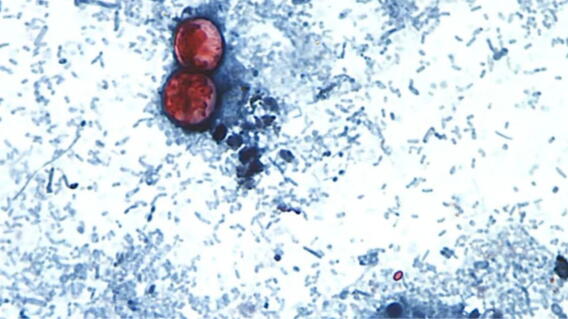 Sigue alerta por brote de ciclosporiasis: caen ventas de Taco Bell y Reino Unido identifica casos