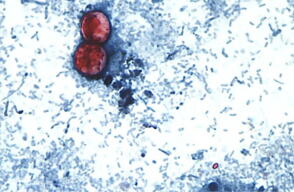 Sigue alerta por brote de ciclosporiasis: caen ventas de Taco Bell y Reino Unido identifica casos