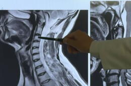Alerta por síndrome de cuello de texto: este es el grave riesgo para la columna cervical