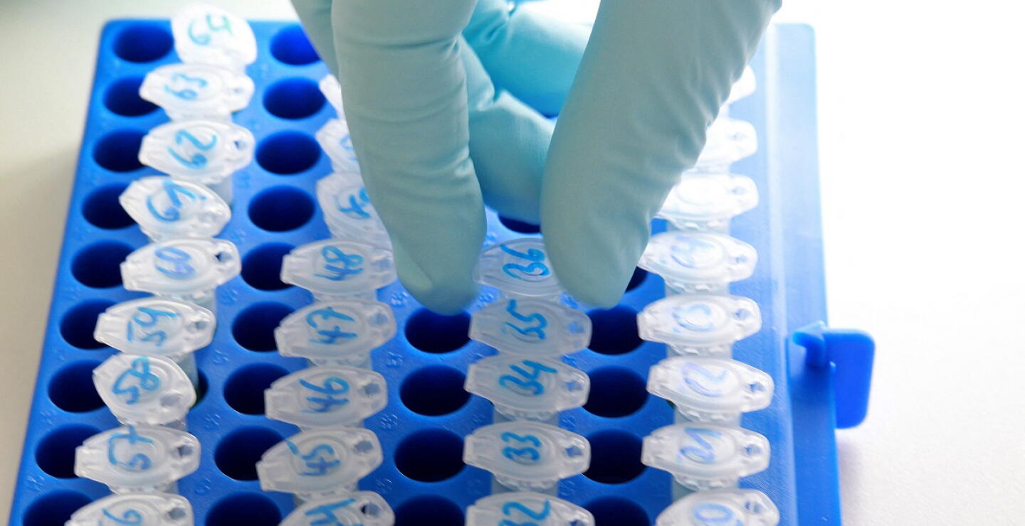 Brote bacteriano de E. coli ya deja un muerto y 15 hospitalizados en EE. UU.
