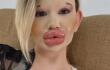 Labios