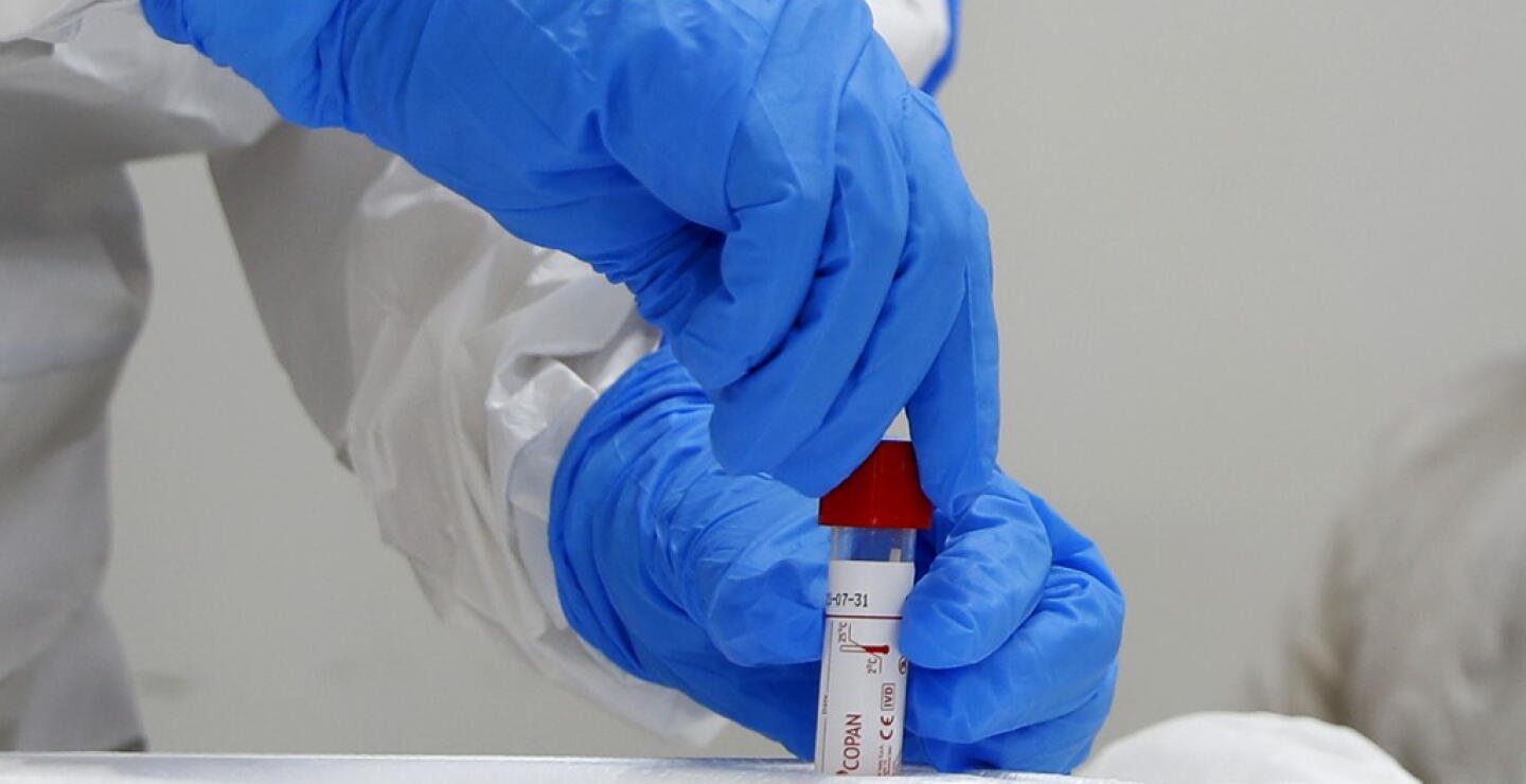 371596_Test coronavirus. Foto: AFP