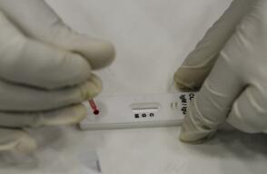 371528_Test coronavirus. Foto: AFP