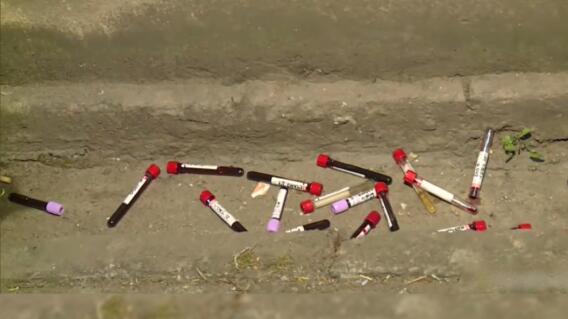 Las muestras de sangre estaban en tubos de ensayo marcados Las muestras de sangre estaban en tubos de ensayo marcados